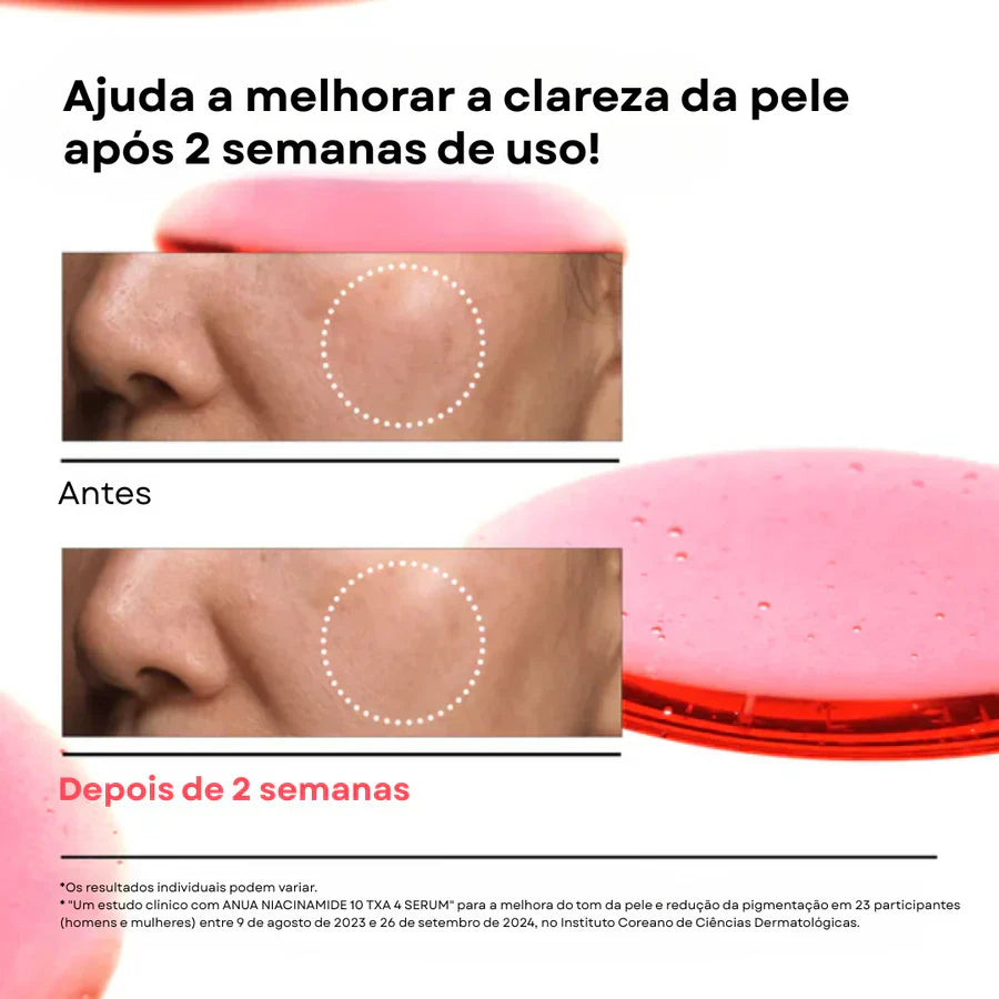 Sérum Niacinamida 10 TXA 4