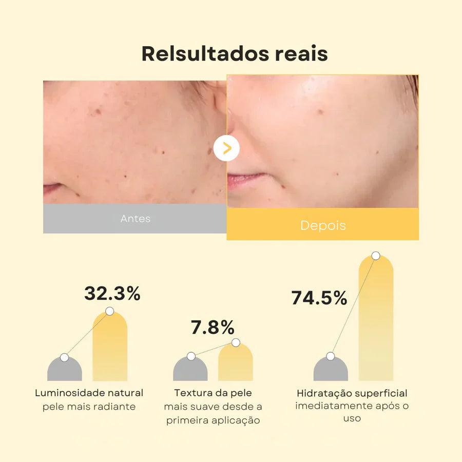 Máscara Jelly Dourada com Ácido Kójico e Cúrcuma Kit com 4